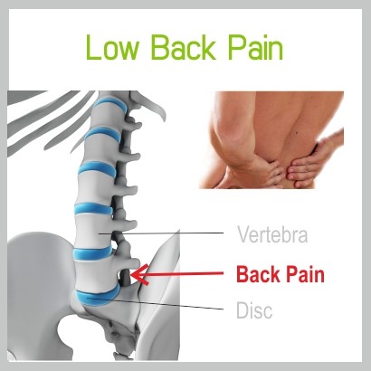 Back Pain Explained