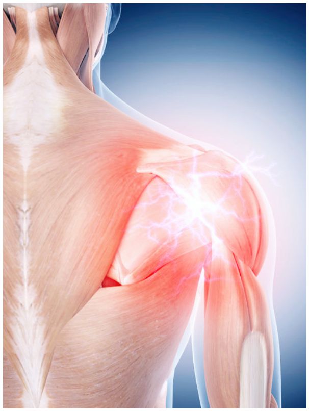 Shoulder-muscles