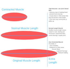 Infographic of over-stretching and pain relief